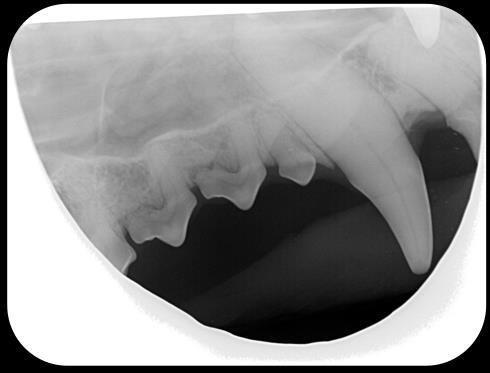 401-404 Treatment for Tooth Resorption Crown