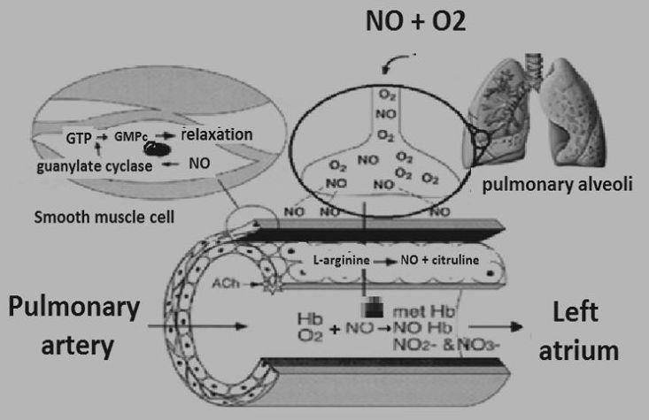 1991 Pepke-Zaba et al. publishes, Inhaled nitric oxide as a cause of selective pulmonary vasodilator in pulmonary hypertension.