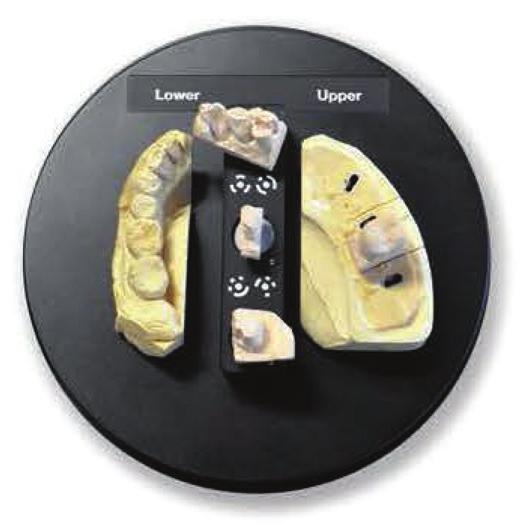 ORIGIN Intelligence HD Dental Scanner Stable Scan Stage Method 3 What? We developed a completely unique system as compared to other conventional system.