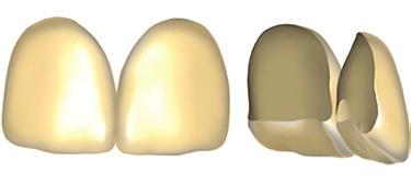 For an even larger selection of tooth shapes, dozens of additional anterior tooth libraries can be purchased as an add-on.