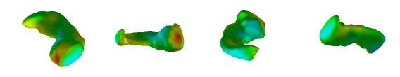 Example support vectors for the hippocampus-amygdala study, shown in pairs of a normal control (top) and a schizophrenia patient