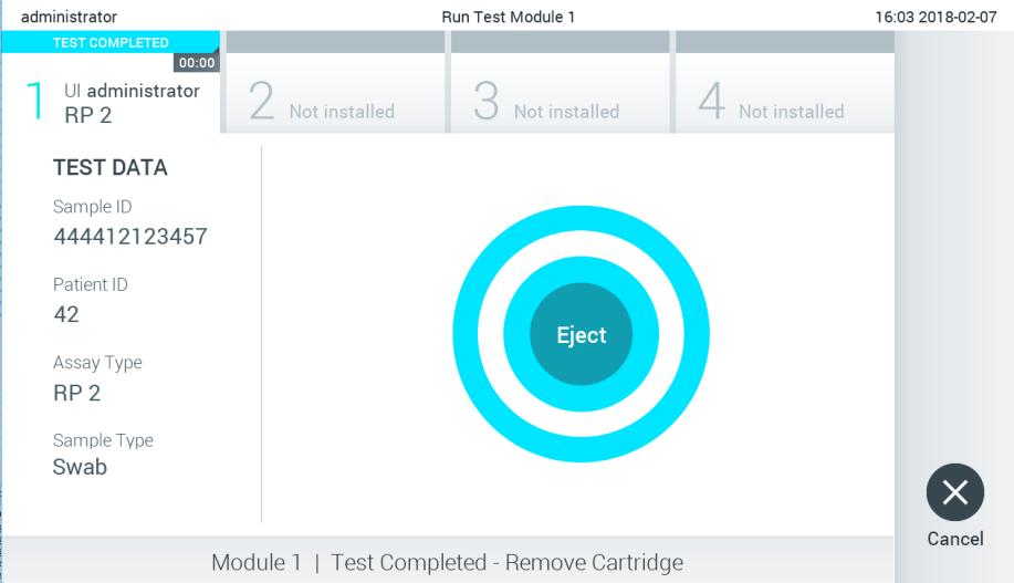 10. After the test run is completed, the Eject screen will appear and the Module Status Bar will show the test result as one of the following options: TEST COMPLETED TEST FAILED TEST CANCELED The