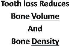 Neil Park DDS CDA White Paper Tooth loss reduces bone DENSITY and bone VOLUME This is what the public knows as BONE RESORPTION Maxillary and mandibular bone structure progressively weakens