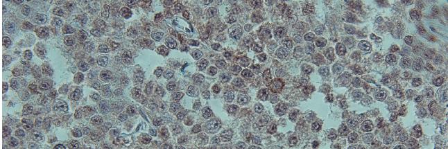 In the present case, Reed-Sternberg cells were histopathologically diagnosed like in human Hodgkin lymphoma.