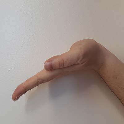 1 A. Wrist in neutral, fingers and thumb is