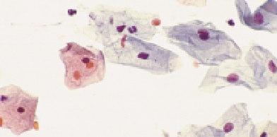 Classification Terminology for Cervical Cytology: The 2001
