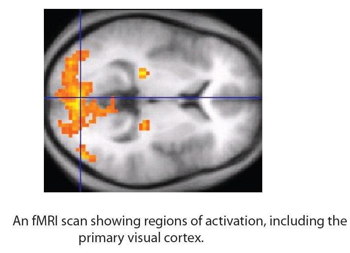 Means functional magnetic resonance imaging Can directly observe both the functions of different structures