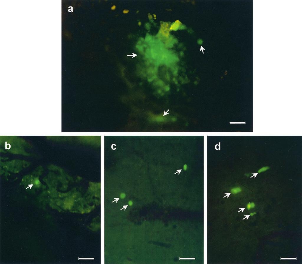 Clinical Cancer Research 3553 Fig. 4 Skull and brain metastasis of LOX cells visualized by GFP. a, tumor metastasized to the skull as visualized by GFP expression (arrows). Bar, 80 m.