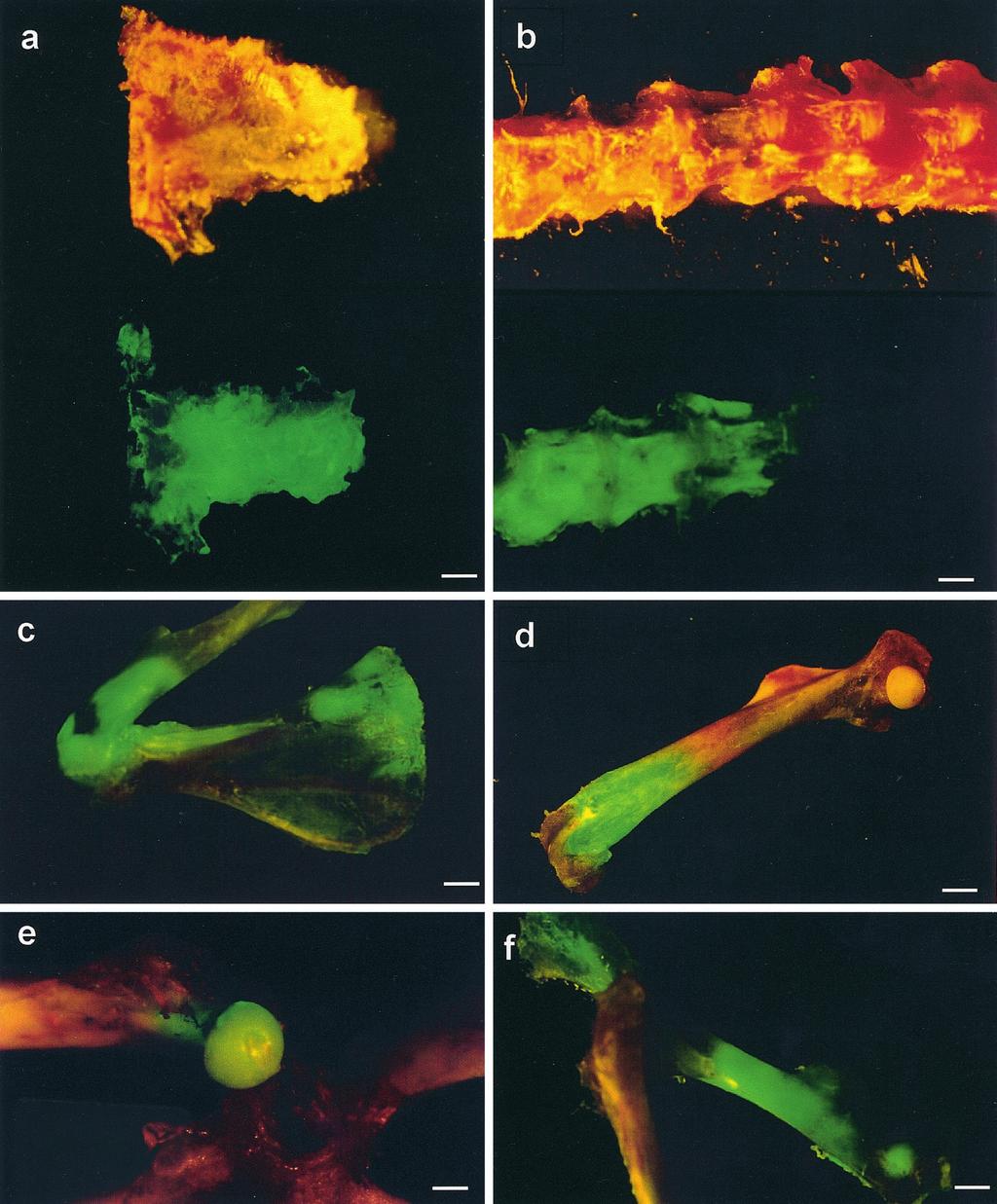 Clinical Cancer Research 3555 Fig. 6 Bone metastasis of B16F0 GFP C1 visualized by GFP. a, skull; top, no metastasis was detected under bright-field microscopy. Bar, 640 mm.