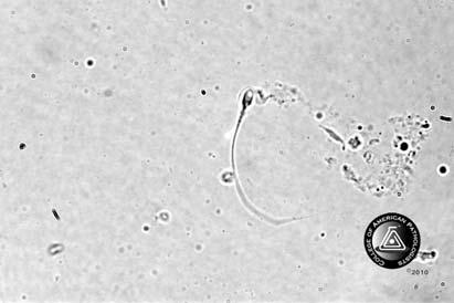 Clinical Microscopy Miscellaneous Photomicrographs/Photographs CMMP-38 Referees CMMP Participants Performance Sperm present 26 100.0 2789 99.