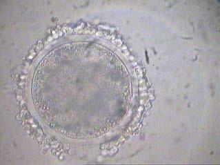 78% (15/19) MII oocytes survived with 47% (9/19)