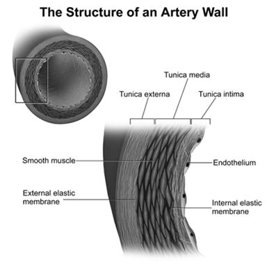 contribute to tensile strength In atherosclerosis, a