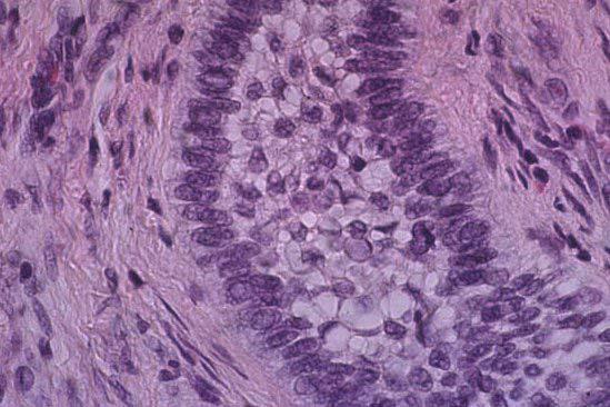 Histology Tumor Tissue Internal Organs Tumor and Internal Organ Tissues Examined by Dr. Jerry Heidel, OSU Dept.