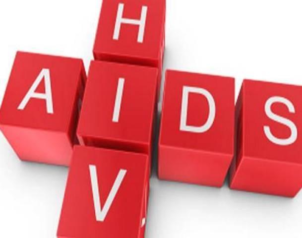 HIV/AIDS It is generally believed that: Human Immunodeficiency