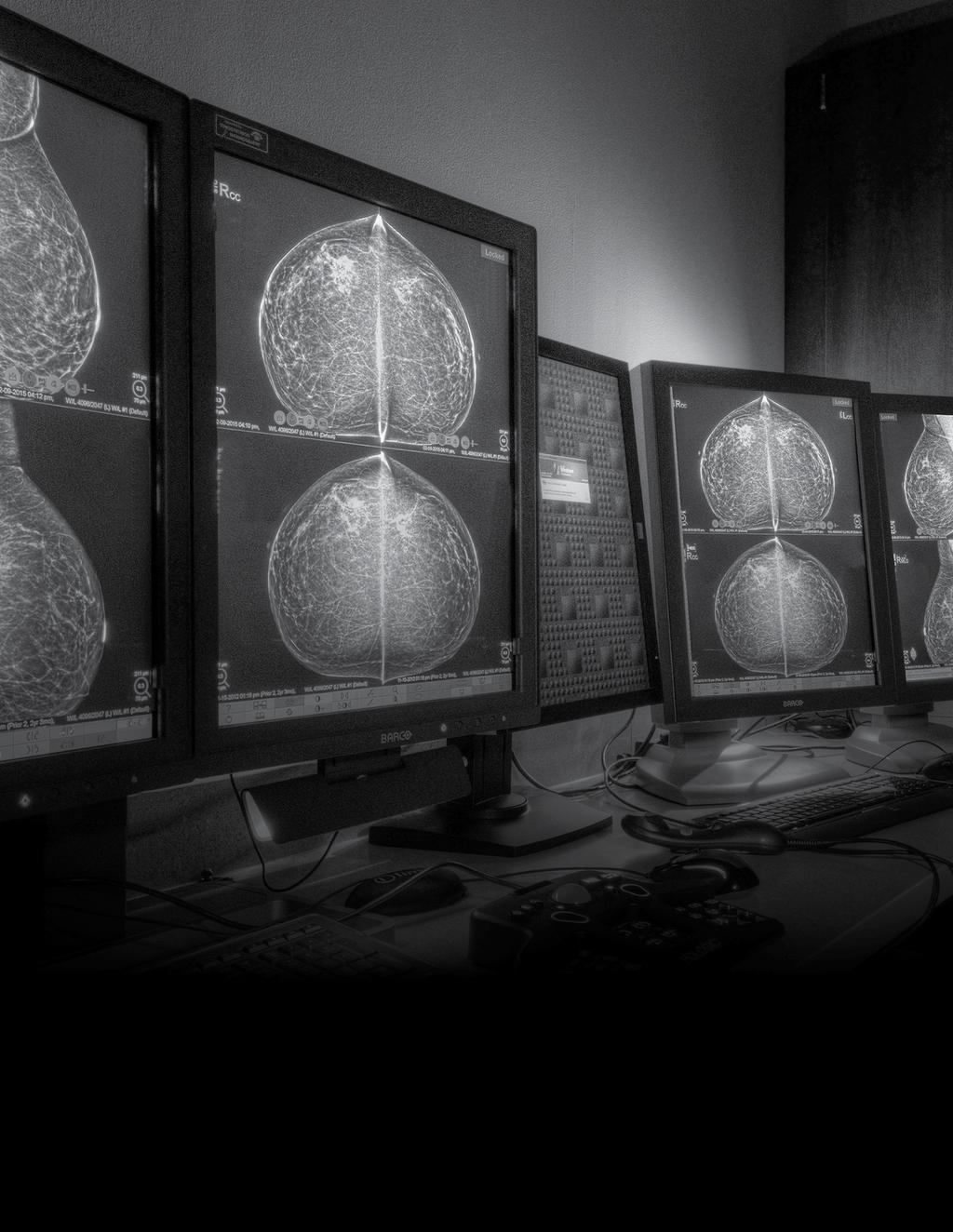 What to Expect During Your Exam A 3D mammography exam is very similar to a traditional mammogram.