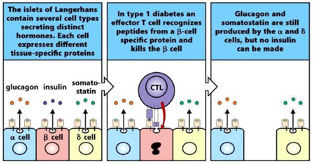 T Pathgenic Present but rle unclear Cells Type 1 Insulin Dependent Diabetes Mellitus - The insulin-secreting B cells in the pancreas are targets f T cells - Activated