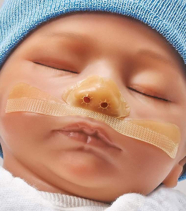 The Cannulaide Family of Securement Devices For and protection Gentle materials provide a skin barrier between the baby and the cannula Nasal holes suspend cannula prongs within the nares, minimizing
