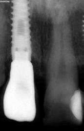 gingival maintenance and