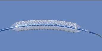 Stent Types Self-expanding Stent placed under a sheath Sheath retraction allows
