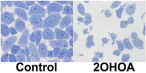 Transmission electron micrographs of human glioma (SF767) cells