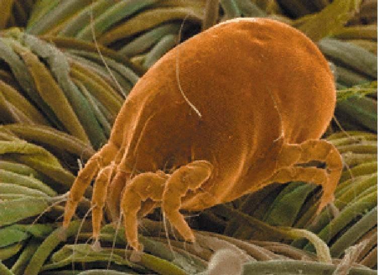 House dust mite allergy House Dust Mite Small 0.