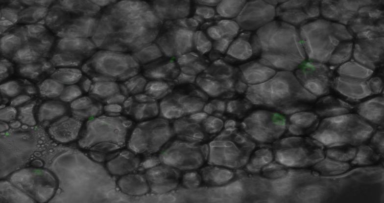 Very small numbers of green cells were detected in the adipocyte fraction from BMT (GFP-Tg WT) mice.
