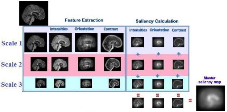 1. Saliency map 2. Normalize 3. GLCM based Feature Extraction 4. SVM classifier 5. Anatomical interpretation 6.