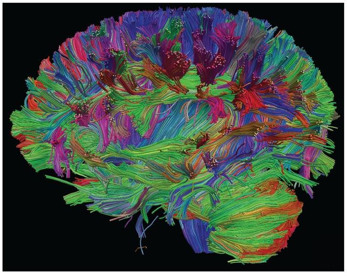 Imaging the Brain 1 The gross structural organization of the brain, can now