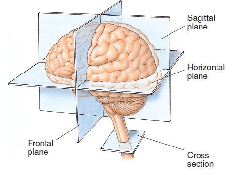 Planes of Section To view the internal structures of the brain, it is usually necessary to slice it up.