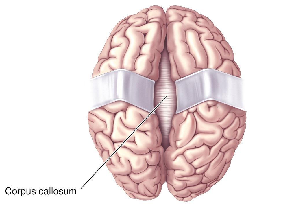 The Cerebrum 2 The cerebral hemispheres are connected by several fiber tracts called commissures. Dorsal view The largest commissure is called the corpus callosum.