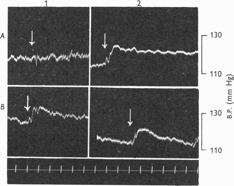 168 SYBIL LLOYD AND MARY PICKFORD bretylium the blood pressure rose 10-15 mm Hg following a dose of 50 m-u. oxytocin in two of the females and the male (Fig. 5A).