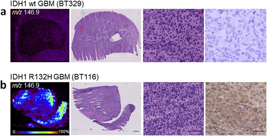 Fig. S6. Two-dimensional DESI MS ion images of human glioma cell xenografts in immunocompromised mice.
