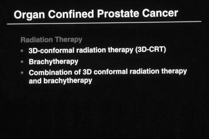 Localized Prostate