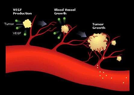 Angiogenesis Tumor growth Dependent on angiogenesis and on vascular endothelial