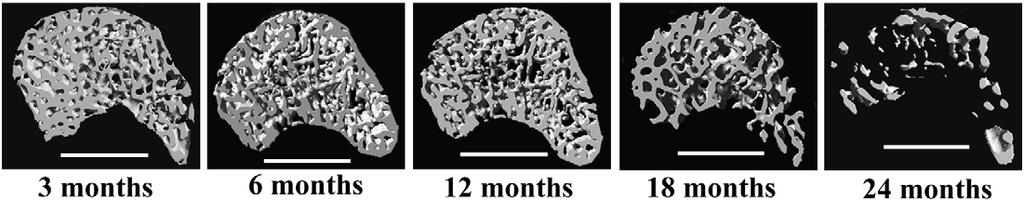 Sophisticated Imaging Technology in the Assessment of Osteoporosis Risk 187 bone microstructure in aging hamsters from 3 to 24 months of age using µct (Chen et al., 2008a).