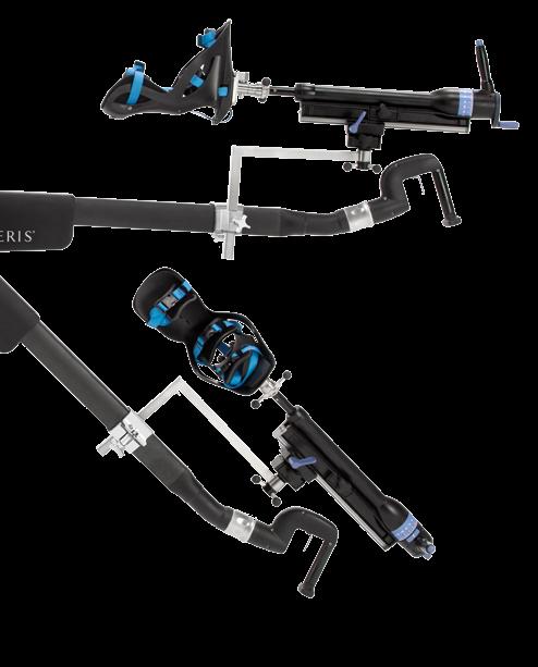 Femur Lift Adjustments (AATHA package) The femur hook adjusts in 30-degree increments along the rail for optimum angles.