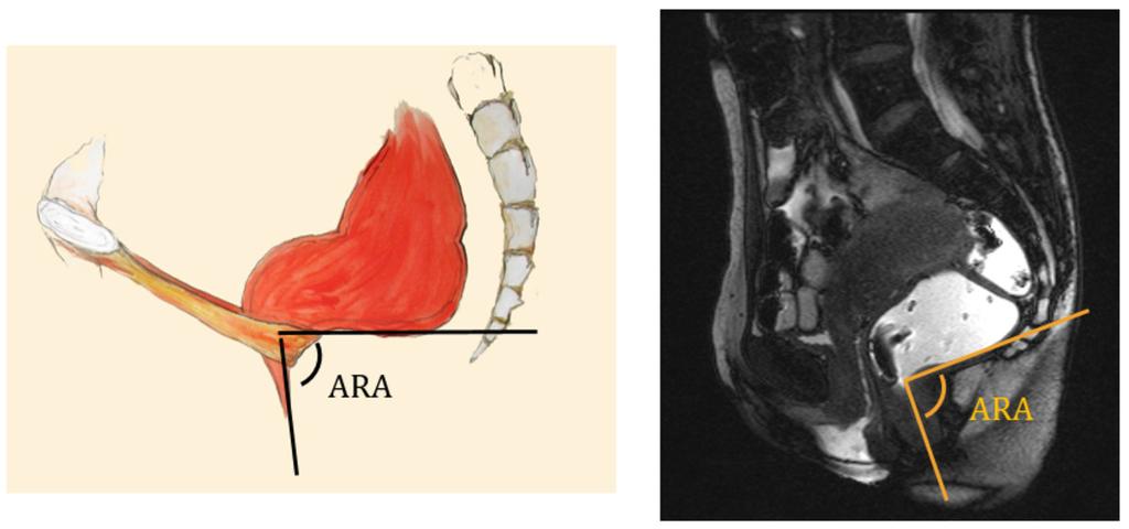 Fig. 17: Ano-rectal junction Jonas Fig.