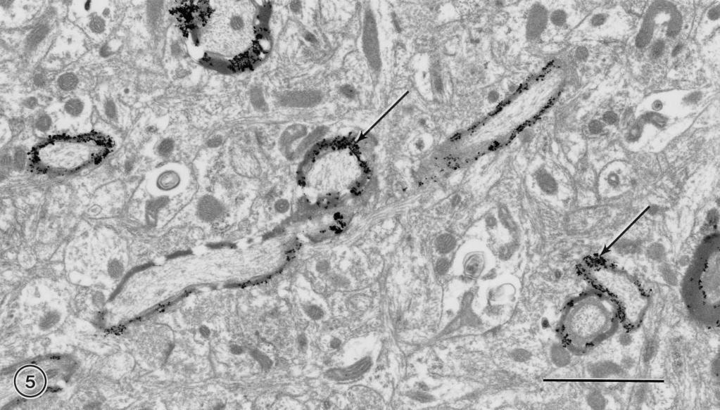 544 McNally, Peters Figure 5 Electron micrograph of a myelin-stained preparation from the striate cortex of a monkey showing the specificity of the stain.