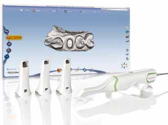 Easy design of inlays, onlays, veneers, crowns and bridges Fully automated design from an anatomic tooth library Design up to 16 teeth in the same session