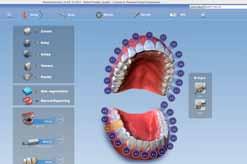 unit Planmeca PlanCAD open CAD software suite designed especially for  The software is easy and fast to use and is ideal for designing prosthetic works from a