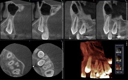 Clinical images 3D FOV Ø 4 x 5 cm/