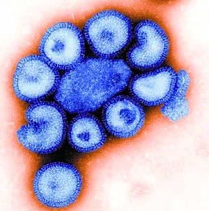 1.1 H1N1 Swine influenza virus ( SIV) is a kind of pigs orthomyxoviridae which can cause local influenza.