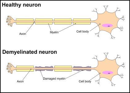 neurological functions of the body (22), but also compromises the structural integrity of myelin and axons, leading to alterations in measurement of tissue alignment and anisotropy (Fig. 2.1) (23).