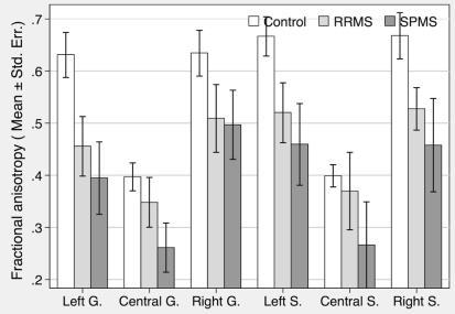 Fig. 215.3: FA outcome in 6 sets of ROIs in corpus callosum.