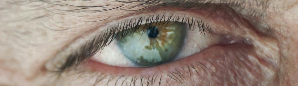 Possible Cataract Surgery Complications Before we discuss the possible complications that could happen with cataract surgery, it s important to stress that the possibility of serious complications