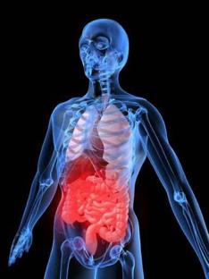 Ulcerative Colitis Long term stress increases the risk of ulcerative colitis flare ups Studies