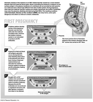 Rh Factors and Pregnancy Spotlight 19-8! First! pregnancy! 40!