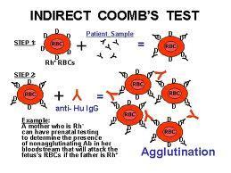 By doing direct coombs test: You take a sample from the baby and do coombs test; add anti IgG, if there is HDN you will get agglutination.
