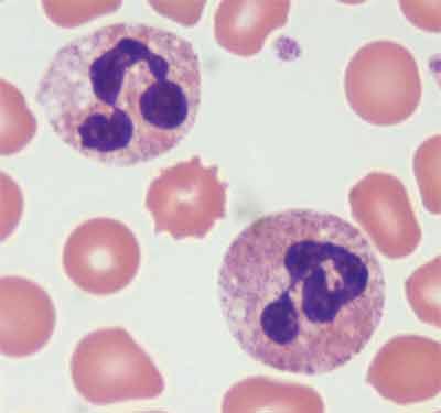 What are Macrophages?