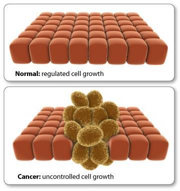 Cancer Cells Cancer cells continue to divide without a stop signal Cancer cells are very densely packed together Starts as a single cell
